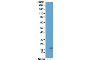 Western blot of acid extracts from HeLa cells untreated (-) or treated (+) with sodium butyrate using recombinant H3K18ac antibody at 0. (Recombinant Histone 3 antibody  (acLys18))