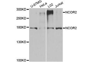 Western blot analysis of extracts of various cell lines, using NCOR2 antibody. (NCOR2 antibody)