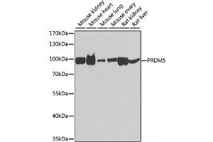 Western blot analysis of extracts of various cell lines using PRDM5 Polyclonal Antibody at dilution of 1:1000. (PRDM5 antibody)