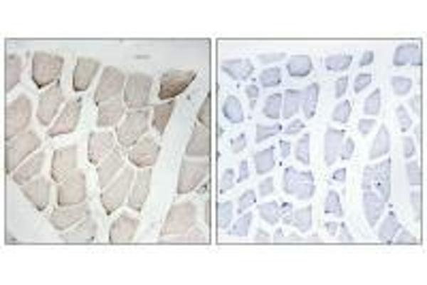 Myomesin 1 antibody