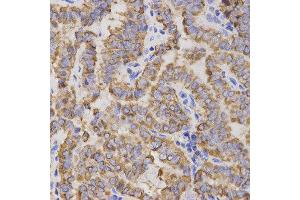 Immunohistochemistry (IHC) image for anti-Glycoprotein IX (Platelet) (GP9) antibody (ABIN1876562) (CD42a antibody)