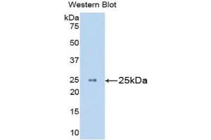 Western blot analysis of the recombinant protein. (Mannose Associated Serine Protease 2 (AA 22-142) antibody)