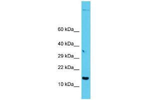 Host: Rabbit Target Name: GAGE12I Sample Type: PANC1 Whole Cell lysates Antibody Dilution: 1. (G Antigen 12I antibody  (C-Term))