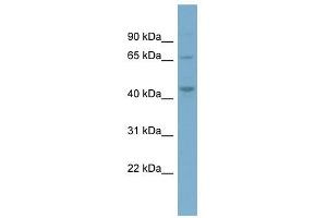 PIP4K2A antibody used at 1 ug/ml to detect target protein. (PIP4K2A antibody  (Middle Region))