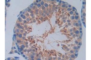 Detection of CCND2 in Mouse Testis Tissue using Polyclonal Antibody to Cyclin D2 (CCND2) (Cyclin D2 antibody  (AA 47-267))