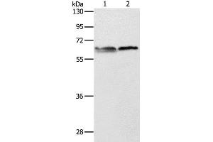 Western Blot analysis of 293T and Jurkat cell using ALAS2 Polyclonal Antibody at dilution of 1:1000 (ALAS2 antibody)