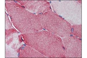 Immunohistochemistry Image: Human Skeletal Muscle: Formalin-Fixed, Paraffin-Embedded (FFPE) (Junctophilin 2 antibody  (C-Term))