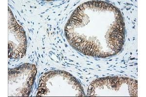 Immunohistochemical staining of paraffin-embedded Human liver tissue using anti-BSG mouse monoclonal antibody. (CD147 antibody)