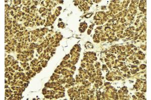 ABIN6268923 at 1/100 staining Mouse pancreas tissue by IHC-P.