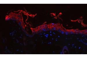 IF analysis of Cytokeratin 1/Krt1 using anti-Cytokeratin 1/Krt1 antibody (ABIN7600713).