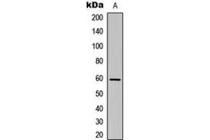 Western blot analysis of Cadherin 23 expression in HEK293T (A) whole cell lysates. (CDH23 antibody  (N-Term))