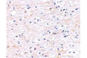 Immunohistochemical staining of human brain tissue using FNBP1L polyclonal antibody  at 2.