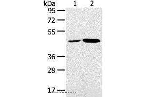 Western blot analysis of K562 and Jurkat cell, using SNX5 Polyclonal Antibody at dilution of 1:250