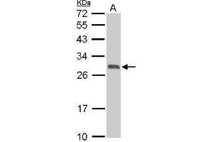 WB Image 14-3-3 sigma antibody detects SFN protein by Western blot analysis. (14-3-3 sigma/SFN antibody  (C-Term))
