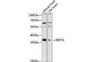 Western blot analysis of extracts of various cell lines, using RRP7A antibody (ABIN6133010, ABIN6147275, ABIN6147276 and ABIN6225048) at 1:3000 dilution. (RRP7A antibody  (AA 1-280))