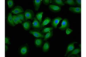 Immunofluorescence staining of A549 cells with ABIN7151731 at 1:133, counter-stained with DAPI. (ECSCR antibody  (AA 25-124))