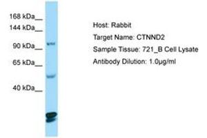 Image no. 1 for anti-Catenin (Cadherin-Associated Protein), delta 2 (Neural Plakophilin-Related Arm-Repeat Protein (CTNND2) (AA 1066-1115) antibody (ABIN6749992) (CTNND2 antibody  (AA 1066-1115))