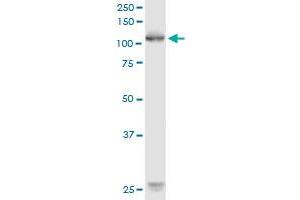 ROR1 monoclonal antibody (M02), clone 1B4. (ROR1 antibody  (AA 294-393))