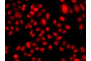 Immunofluorescence analysis of A549 cells using TEAD3 antibody (ABIN5975292). (TEAD3 antibody)
