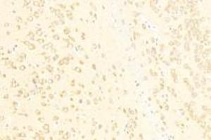 Immunohistochemistry (Paraffin-embedded Sections) (IHC (p)) image for anti-ADAM Metallopeptidase with Thrombospondin Type 1 Motif, 4 (ADAMTS4) antibody (ABIN7072947)