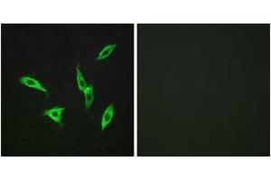 Immunofluorescence analysis of LOVO cells, using ADORA2B Antibody. (Adenosine A2b Receptor antibody  (AA 231-280))
