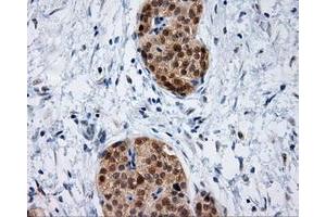 Immunohistochemical staining of paraffin-embedded Kidney tissue using anti-IFT57 mouse monoclonal antibody. (IFT57 antibody)