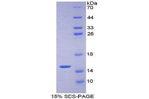 SDS-PAGE (SDS) image for Solute Carrier Family 2 (Facilitated Glucose Transporter), Member 1 (SLC2A1) (AA 251-329) protein (His tag) (ABIN1079653) (GLUT1 Protein (AA 251-329) (His tag))