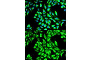 Immunofluorescence analysis of HeLa cells using EEF1A1 antibody. (eEF1A1 antibody)