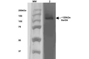 Western Blot analysis of Rat Brain Membrane showing detection of ~120 kDa SUR2A protein using Mouse Anti-SUR2A Monoclonal Antibody, Clone S319A-14 .