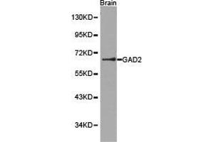 Western Blotting (WB) image for anti-Glutamate Decarboxylase 2 (Pancreatic Islets and Brain, 65kDa) (GAD2) antibody (ABIN1872768) (GAD65 antibody)