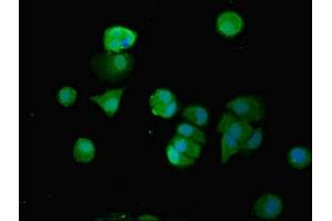 Immunofluorescent analysis of MCF-7 cells using ABIN7171717 at dilution of 1:100 and Alexa Fluor 488-congugated AffiniPure Goat Anti-Rabbit IgG(H+L) (SMG6 antibody  (AA 251-511))