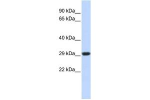 WB Suggested Anti-SDHB Antibody Titration:  0. (SDHB antibody  (Middle Region))