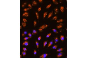 Immunofluorescence analysis of L929 cells using GRID1 Rabbit pAb (ABIN6129019, ABIN6141391, ABIN6141393 and ABIN6224034) at dilution of 1:100 (40x lens). (GRID1 antibody  (AA 880-1009))
