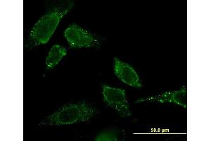 Immunofluorescence of monoclonal antibody to CBR3 on HeLa cell. (CBR3 antibody  (AA 180-277))