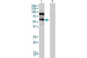 Lane 1: DDX41 transfected lysate ( 70 KDa). (DDX41 HEK293 Cell Transient Overexpression Lysate(Non-Denatured))