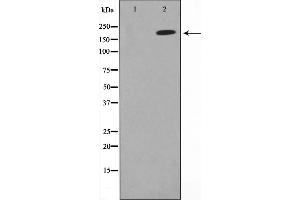 Western blot analysis on A549 cell lysate using MAGI2 Antibody,The lane on the left is treated with the antigen-specific peptide. (MAGI2 antibody  (N-Term))