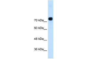 WB Suggested Anti-ACTN4  Antibody Titration: 0. (alpha Actinin 4 antibody  (N-Term))