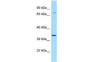 WB Suggested Anti-RASL11A Antibody Titration: 1. (RASL11A antibody  (N-Term))