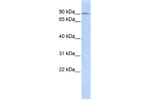 WB Suggested Anti-NCAPH Antibody Titration:  0.