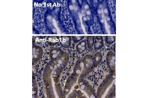 Immunohistochemistry (IHC) image for anti-RAB1B, Member RAS Oncogene Family (RAB1B) (C-Term) antibody (ABIN6254186)