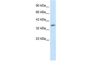 WB Suggested Anti-HEYL Antibody Titration: 1. (HEYL antibody  (N-Term))