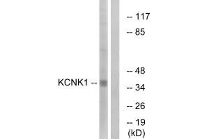 Western blot analysis of extracts from Jurkat cells, using KCNK1 antibody. (KCNK1 antibody  (C-Term))