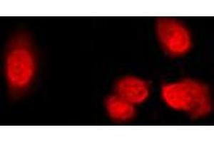 Immunofluorescent analysis of Histone Deacetylase 5 (pS498) staining in Raw264. (HDAC5 antibody  (pSer498))