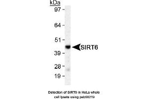 Image no. 1 for anti-Sirtuin 6 (SIRT6) (AA 300-355), (C-Term) antibody (ABIN363528) (SIRT6 antibody  (C-Term))