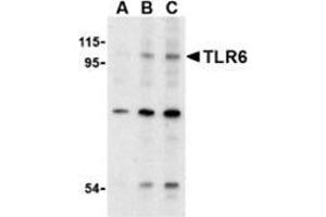 Western blot analysis of TLR6 in Jurkat cell lysate with TLAP30903PU-N at (A) 0.