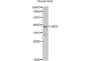 Western blot analysis of extracts of mouse heart, using LIMS1 antibody (ABIN6293172) at 1:1000 dilution.