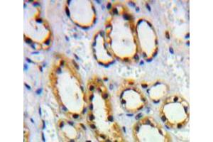 Used in DAB staining on fromalin fixed paraffin- embedded Kidney tissue (HVEM antibody  (AA 41-209))