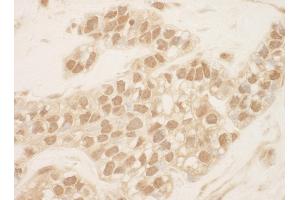 Immunohistochemistry (IHC) image for anti-Cullin 2 (CUL2) (AA 150-200) antibody (ABIN7448503)