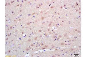 Formalin-fixed and paraffin embedded rat brain labeled with Rabbit Anti Trk A/B/C Polyclonal Antibody, Unconjugated (ABIN726095) at 1:200 followed by conjugation to the secondary antibody and DAB staining (TrkA, B, C (AA 668-750) antibody)