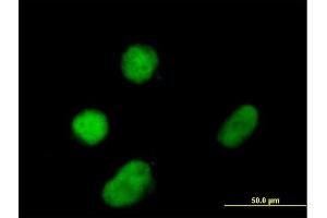 Immunofluorescence of purified MaxPab antibody to ZNF131 on Daoy cell.
